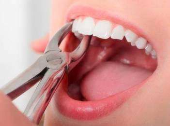 Стоматолог из Петербурга выслала пациентке 22 крепких зуба