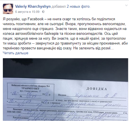 Валерий Харчишин был покусан собакой: в скорой и полиции не смогли помочь певцу